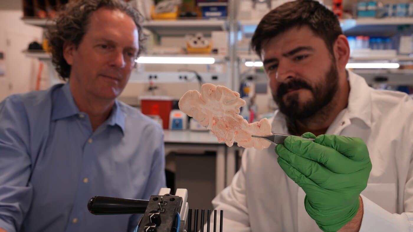 The Allen Institute has developed a complete description of the types of cells that make up the brain.